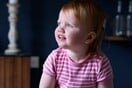 Βρετανία: Αποκαταστάθηκε η ακοή νηπίου με γονιδιακή θεραπεία